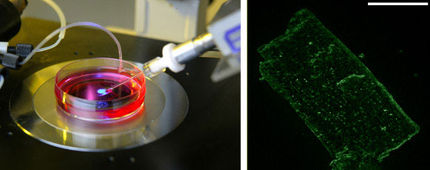 Forscher identifizierten Mechanismus zur Entstehung von Herz-Kreislauferkrankungen