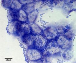 Studie zum EHEC-Ausbruchsstamm HUSEC041