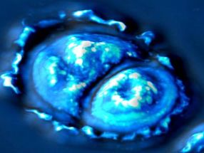New imaging method sheds light on cell growth