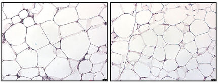 Die Fettzellen der Wildtyp-Mäuse aus der Kontrollgruppe (links) sind nach der Fettdiät deutlich größer als die der Mäuse mit deaktiviertem GR-Rezeptor (rechts), bei denen das Cortisol-vermittelte Stresssignal blockiert ist.
