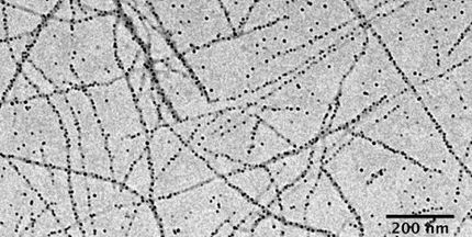 Essbare Molkeprotein-Nanofasern binden auf ihrer Oberfläche Eisen-Nanopartikel (schwarze Punkte). Dieses Präparat könnte Eisenmangel auf effiziente und günstige Weise bekämpfen.