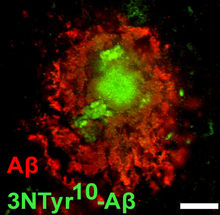 Schutz vor der Alzheimer-Erkrankung