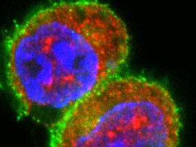 Autoimmune Reaction Successfully Halted in Early Stage Islet Autoimmunity