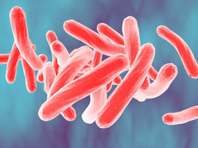 Neuer resistenter Tuberkulose-Erreger entdeckt