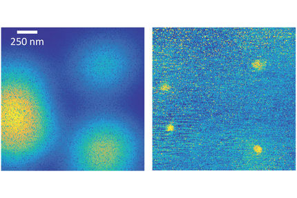 Mikroskopie: Auflösung von 30 Nanometern erreicht