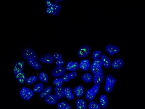 A protein that keeps metastatic breast cancer cells dormant