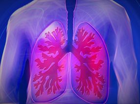 Airway-branch variations associated with higher COPD prevalence