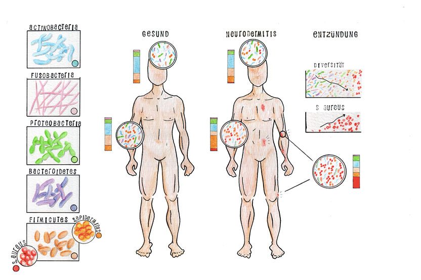 Abbildung/Copyright: Holly McKelvey/Exzellenzcluster „Inflammation at Interfaces“