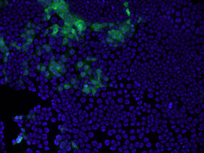 Neuer Behandlungsansatz für Hepatitis E Virus Infektionen bei Schwangeren