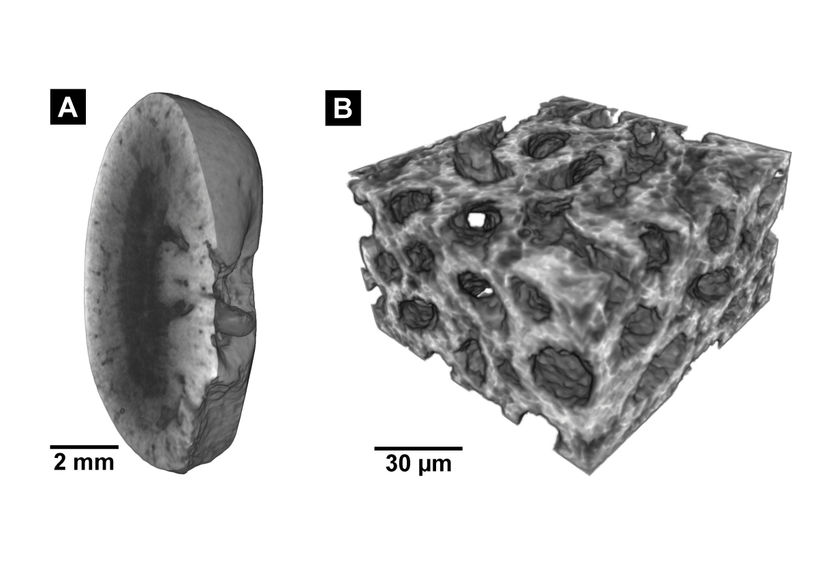 Müller, Pfeiffer / TUM / reproduced with permission from PNAS)