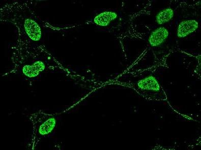 ALS-linked protein's journey into nervous system cells more complex than we thought
