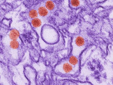 How reliable is diagnostic testing for Zika?