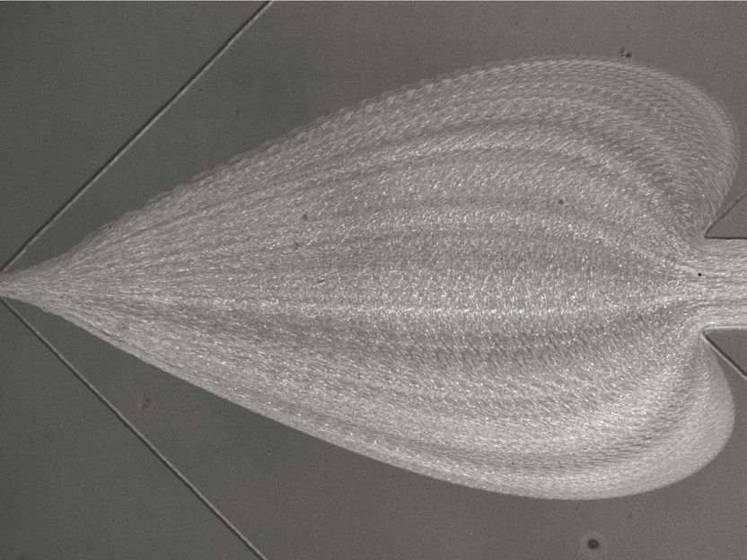 Schnelle Diagnose von Krankheiten mit neuartigem Bluttest