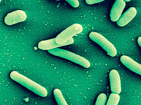 Neuer Hemmstoff gegen hartnäckige bakterielle Biofilme