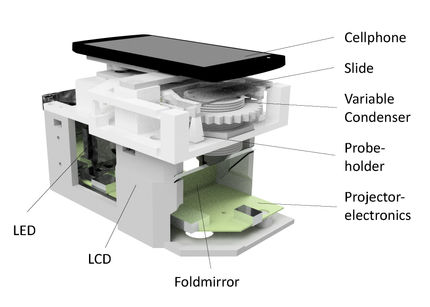 Mehr als Schnappschüsse: Das Smartphone als preiswertes Hochleistungsmikroskop