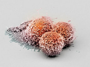 Neu entdecktes Protein verhindert ungehinderte Vermehrung von Krebszellen