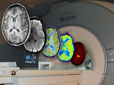 Looking deeper into brain function - New concept to discover the "operational functions" of brain areas