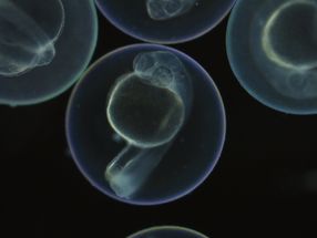 Neue Technik kann Art und Herkunft aller Zellen in einem Organismus gleichzeitig ermitteln