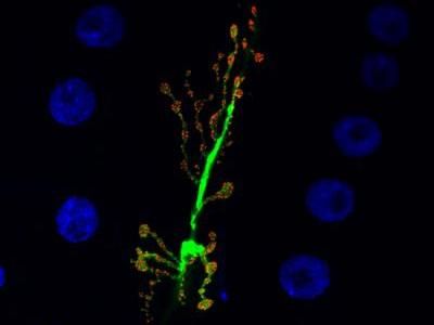 Deciphering the 'mosaic' of the brain