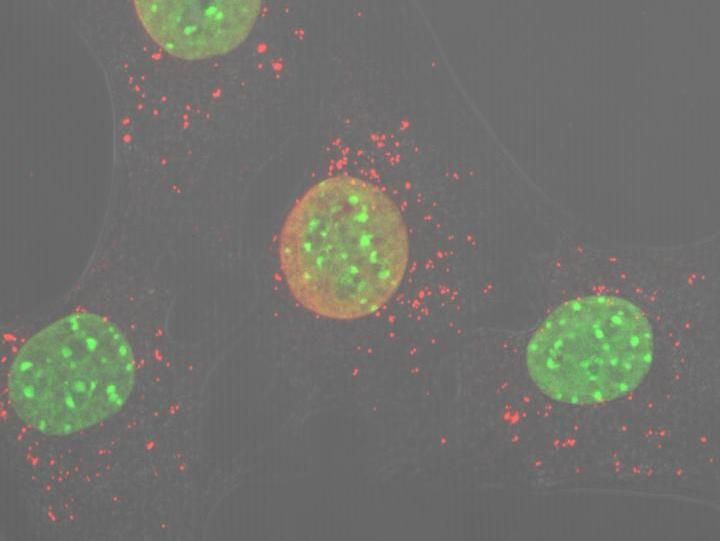 La falta de una única proteína mitocondrial genera inflamación severa