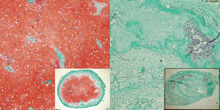Researchers succeed in cultivating cartilage from stem cells