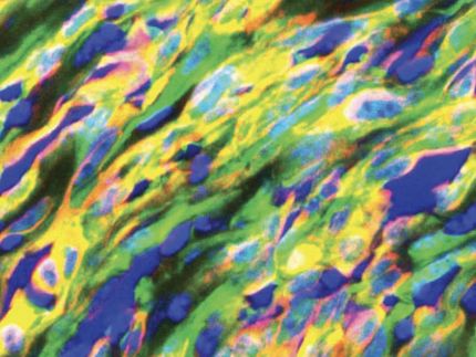 Cancer: Tumor transition states