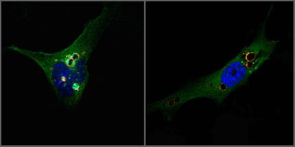 DOR protein deficiency favors the development of obesity