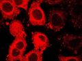 GLUT5 fluorescent probe fingerprints cancer cells