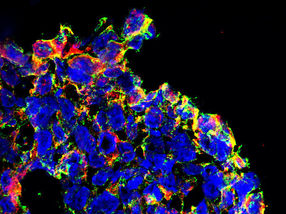 Neuer Wirkmechanismus von Tumortherapeutikum entdeckt