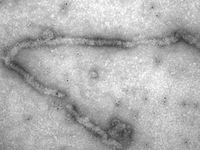 Desarrollan nuevas vacunas contra el virus del Ebola