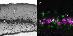 Tracing cerebral cortex evolution, cell by cell - Molecular atlases of turtle and lizard brains shed light on the evolution of our own brain