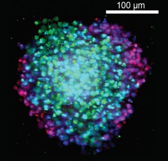 Tumor-like spheres help scientists discover smarter cancer drugs