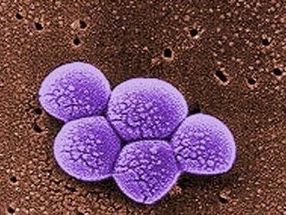 Study: Superbug MRSA infections less costly, but still deadly