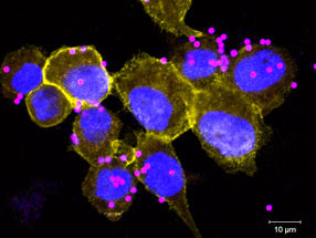 Wie Immunzellen Bakterien mit Säure töten