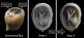 From medical imaging to 3D modelling