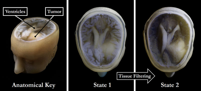 From medical imaging to 3D modelling - 3D printing technique enables faster, better, and cheaper models of patient-specific medical data