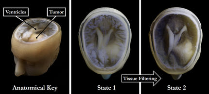 From medical imaging to 3D modelling