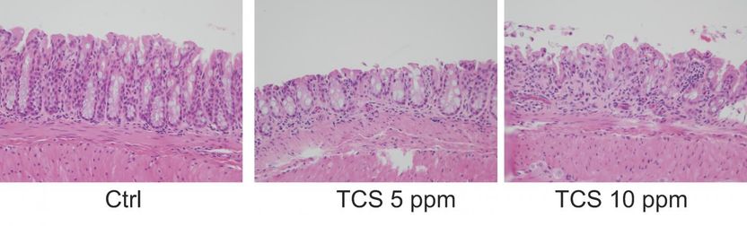 H. Yang et al., Science Translational Medicine (2018)