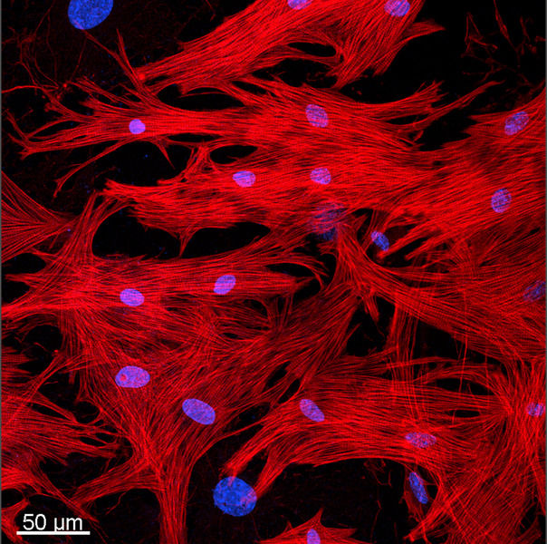 Kranke Herzen sollen sich künftig selbst heilen - Oncostatin M reguliert die Rückverwandlung von Herzmuskelzellen in Vorläuferzellen und ist auf diese Weise von zentraler Bedeutung für die Selbstheilungskräfte des Herzens