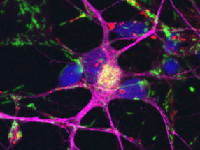 Parkinson: Vitamin B3 hat positive Wirkung auf geschädigte Nervenzellen