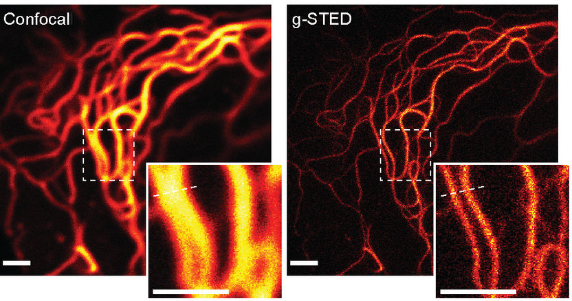 © MPI für biophysikalische Physik