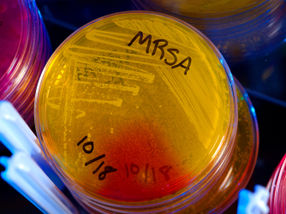Kampf gegen resistente Bakterien: Forscher arbeiten an neuartigen Wirkstoffen