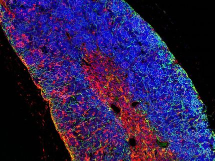 Científicos generan por primera vez una leucemia humana de linfocitos T a partir de una célula sana