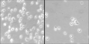 Nuevo fármaco epigenético contra el Linfoma de las Células del Manto
