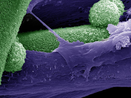 Überdosis Calcium