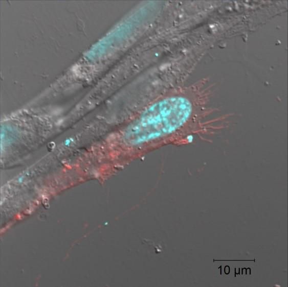 Darleny Lizardo/Alan Siegel/University at Buffalo North Campus Confocal Imaging Facility