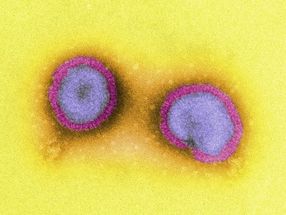 Auf der Suche nach Universal-Grippeimpfstoffen – Neuraminidase unterschätzt?