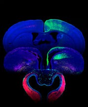 Identifican un mecanismo genético que permitió la evolución de la corteza cerebral de los mamíferos