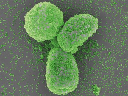 Nanopartikel beeinflussen Schimmelpilzinfektion der Atemwege