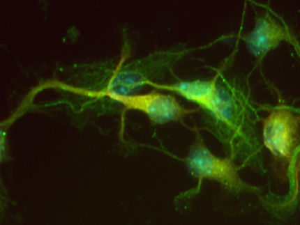 Un estudio muestra nuevas propiedades de una molécula multipotente para el posible tratamiento del Alzheimer